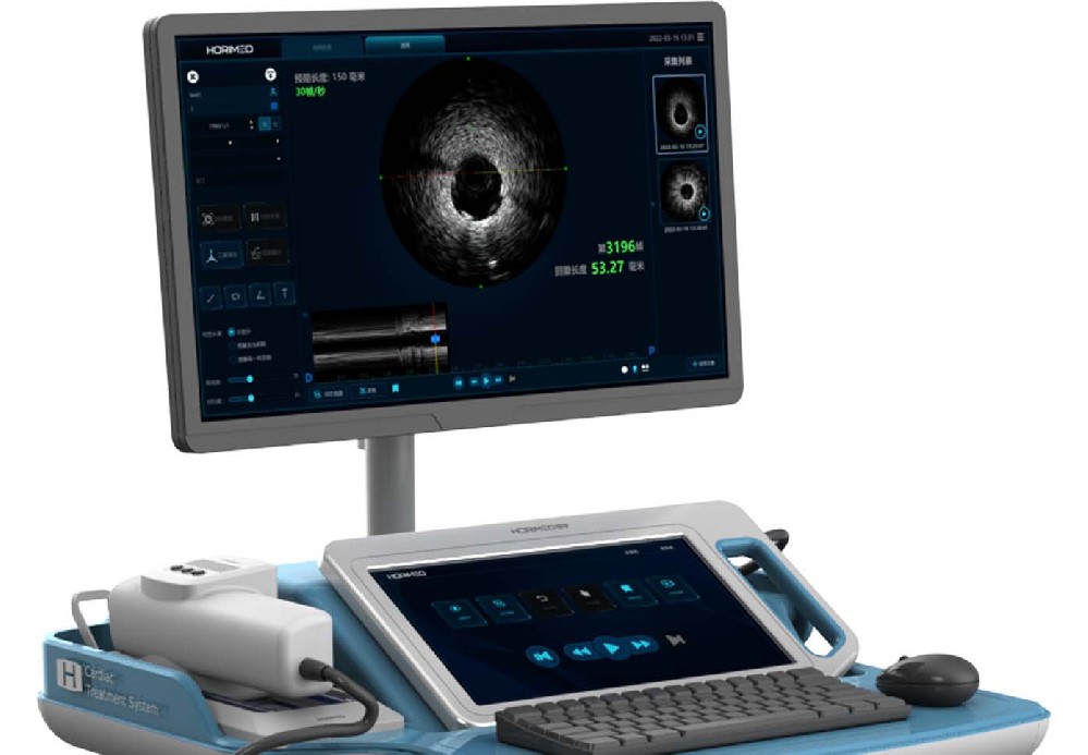 血管内超声系统IVUS